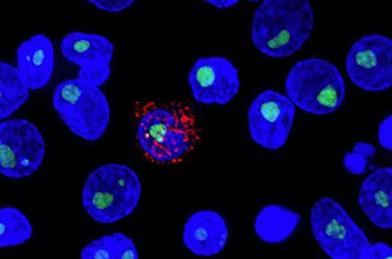 New antibody studies boost hope for HIV cure
