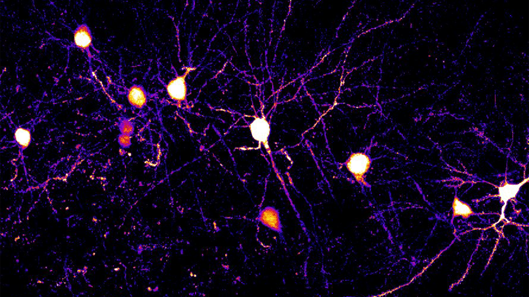 Scientists watch how mice learn, one synapse at a time