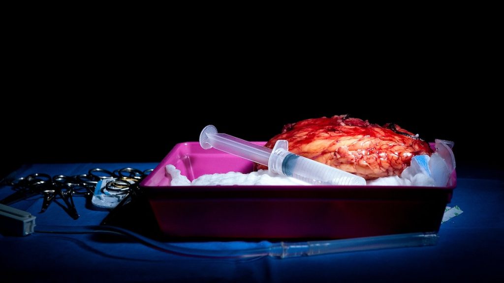 Could organ transplants really help you live to 150? Experts weigh in