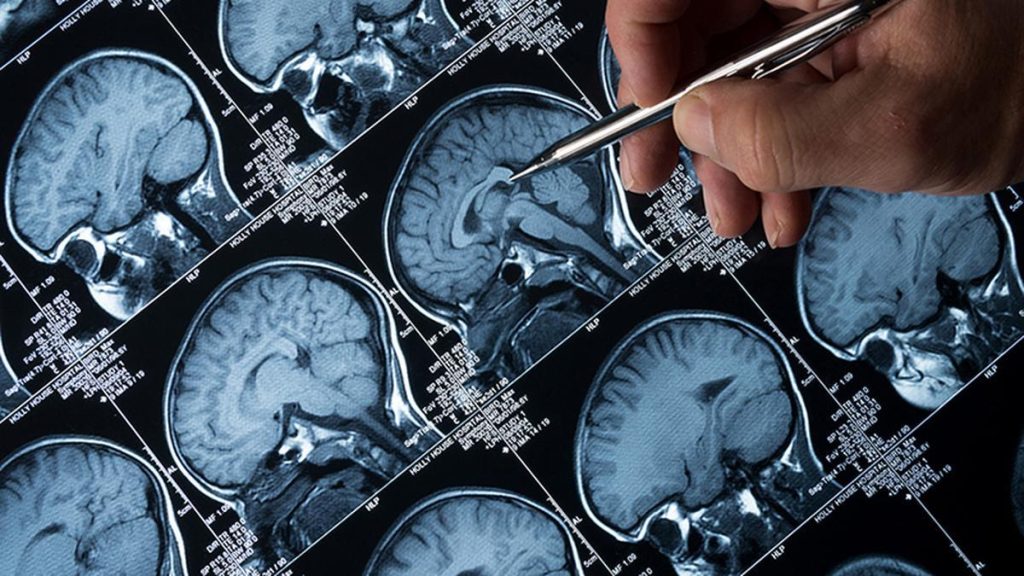 Kerala Doctors Successfully Treat Two Children for Rare Brain Infection