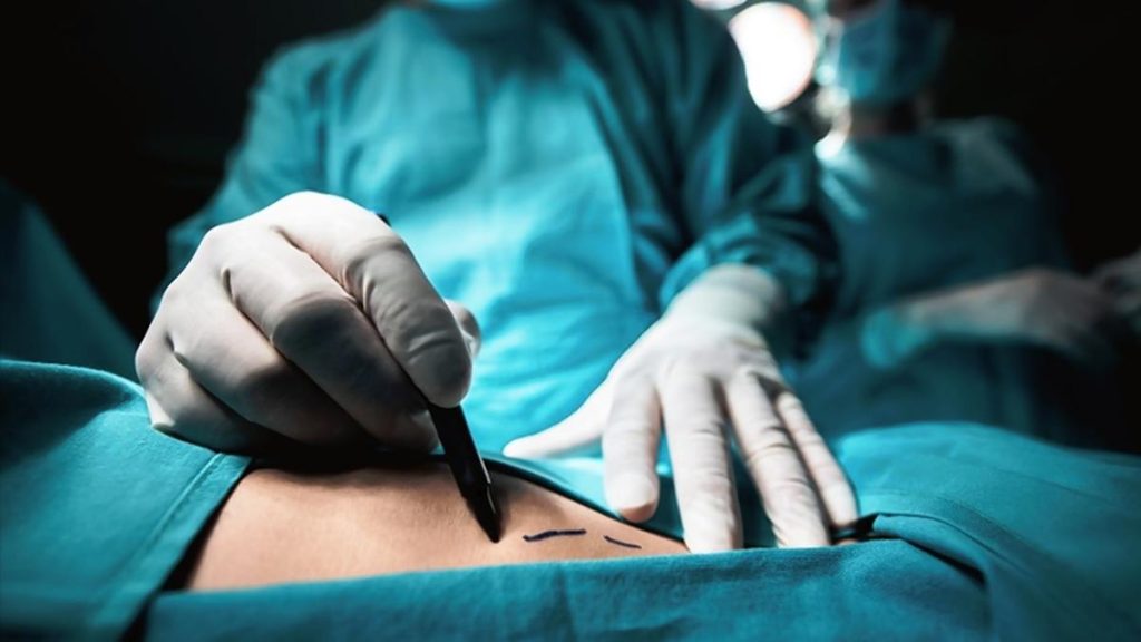 Tamil Nadu sees gradual rise in skin and bone donations