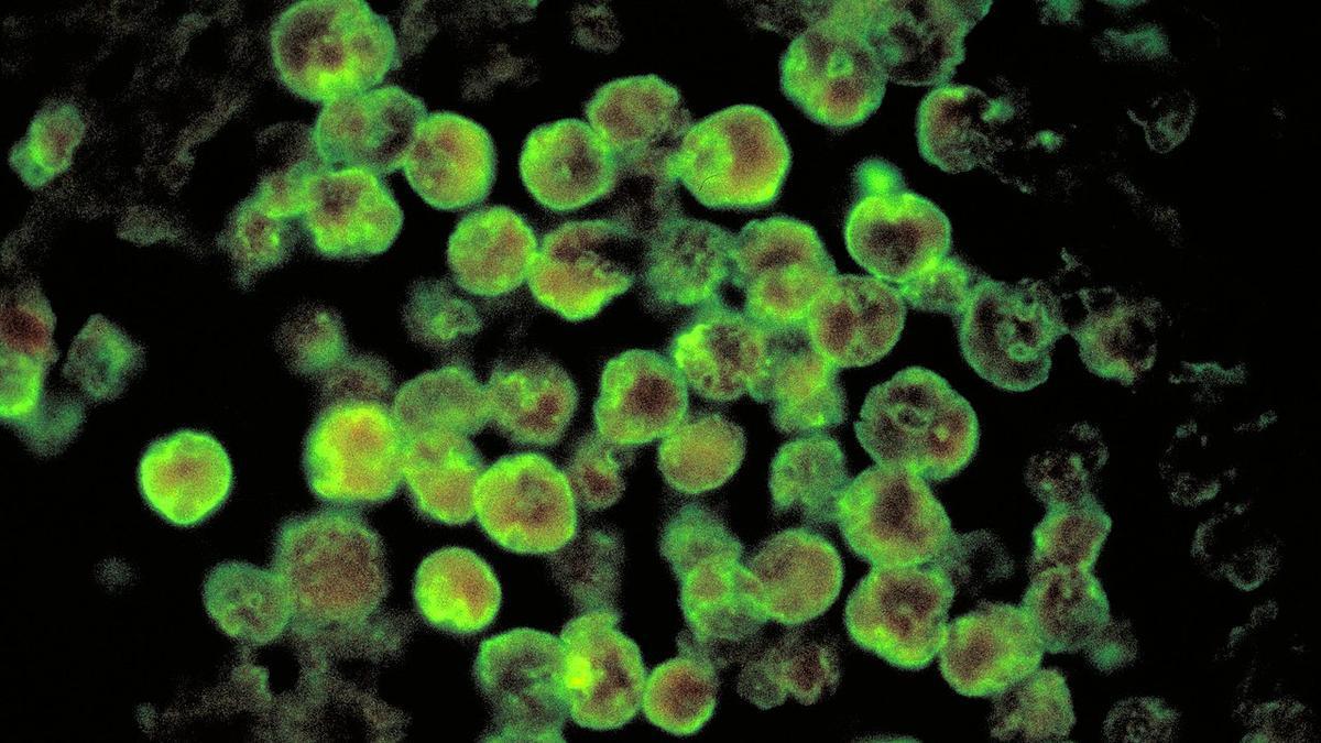 brain-eating-amoeba:-kerala-reports-sixth-amoebic-meningoencephalitis-death-in-a-month