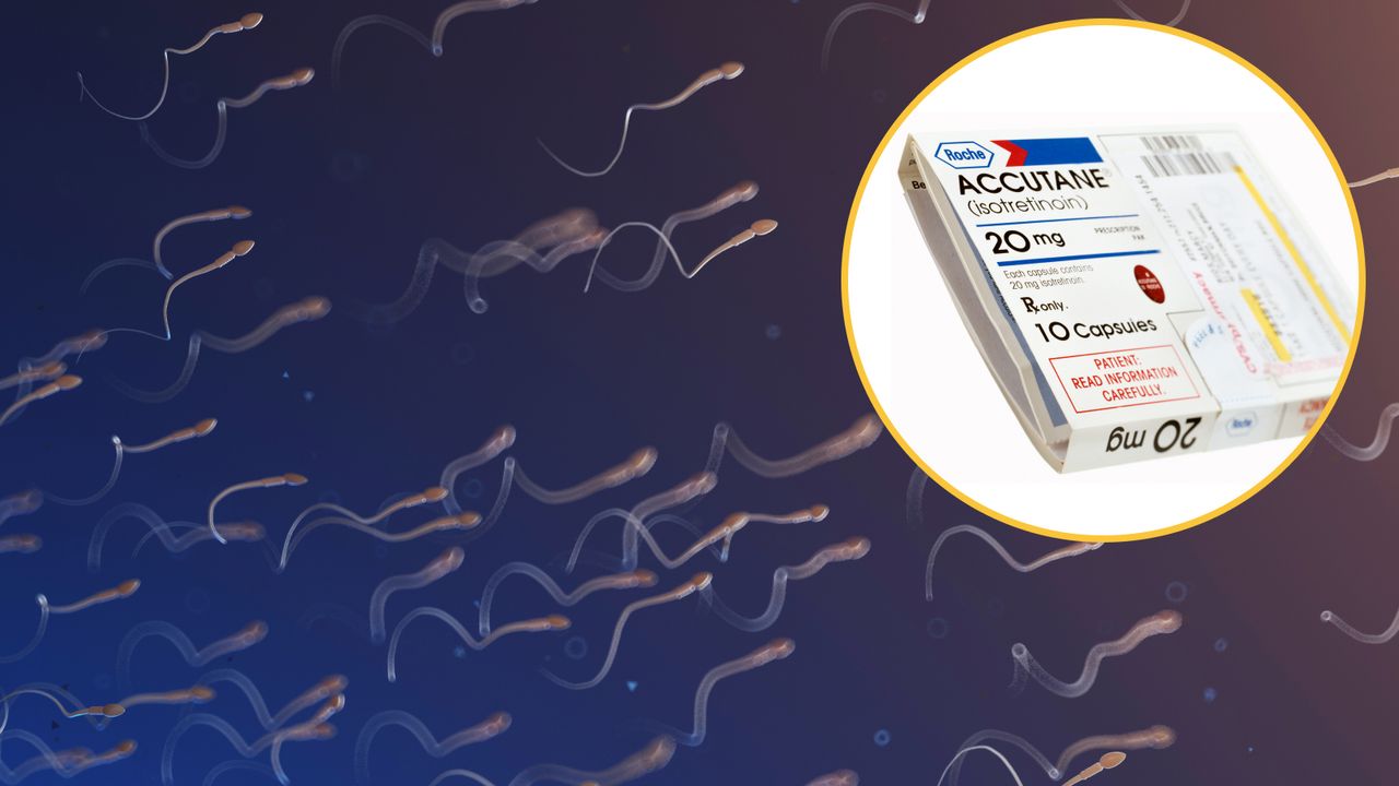 Acne drug Accutane may restore sperm production in infertile men, early study hints